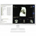 LG 24CK560N-3A All-in-One Thin Client - AMD G-Series GX-212JJ 1.20 GHz - White | SKU LG-24CK56N