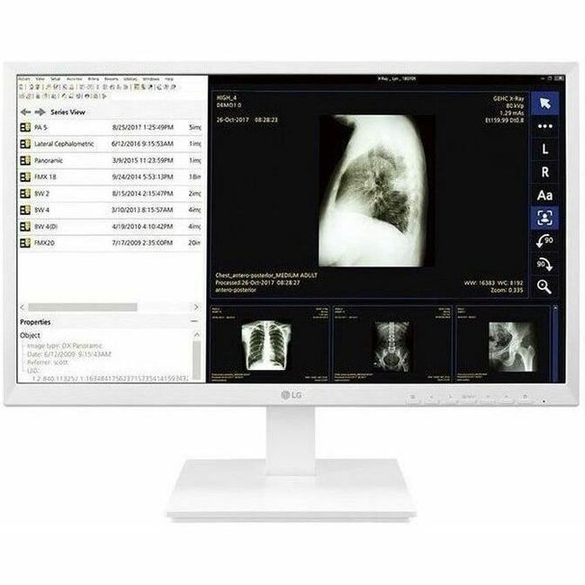 LG 24CK560N-3A All-in-One Thin Client - AMD G-Series GX-212JJ 1.20 GHz - White | SKU LG-24CK56N